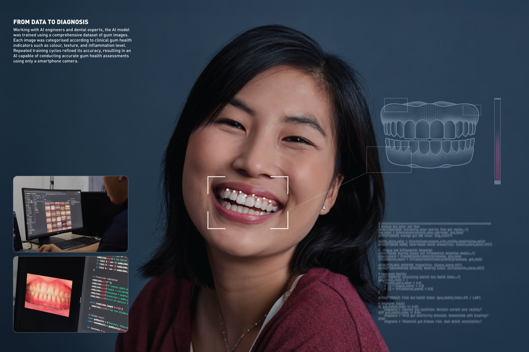 AI model training process for the Systema Gum Health Reveal gum scan tool, showing dataset review and gum health analysis